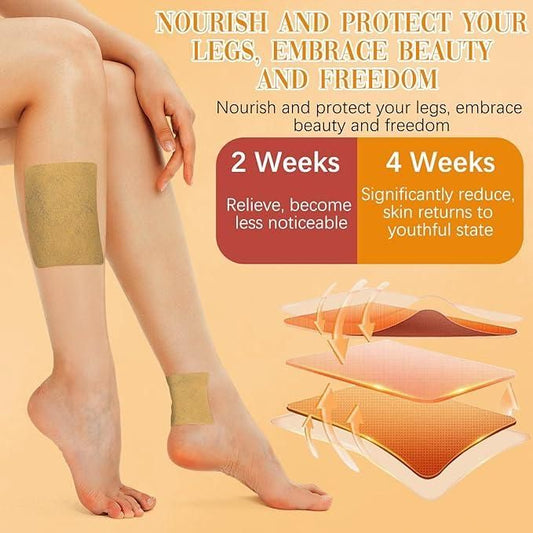Soothe Varicose Veins Naturally – Trusted Turmeric Patches